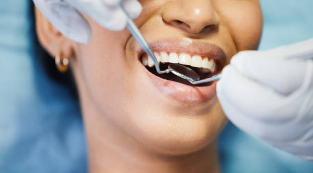 Best Emergency Tooth Extraction in Hudson, TX